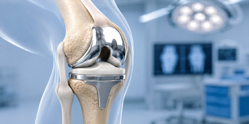 Knee Replacement Surgery in Chennai